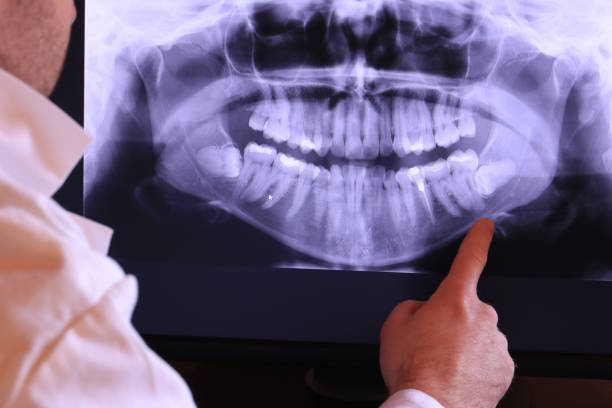 Best Walk-In Emergency Dental Services in Trinity, NC
