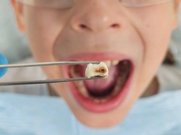 Best 24-Hour Emergency Dental Care in Trinity, NC