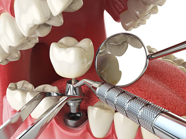 Best Emergency Treatment for Oral Infections in Trinity, NC